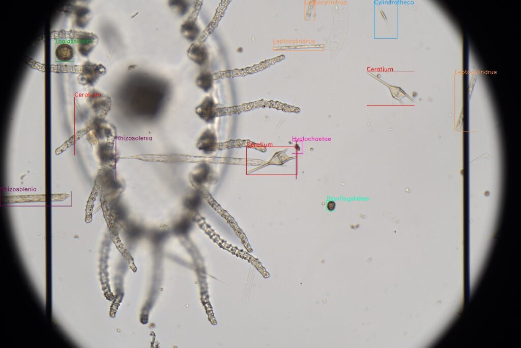 plankton seen through a microscope