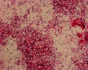 Salmon kidney showing infection with Renibacterium salmoninarum